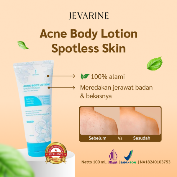 Jevarine - Acne Body Lotion Spotless Skin 100ml Putih Biru